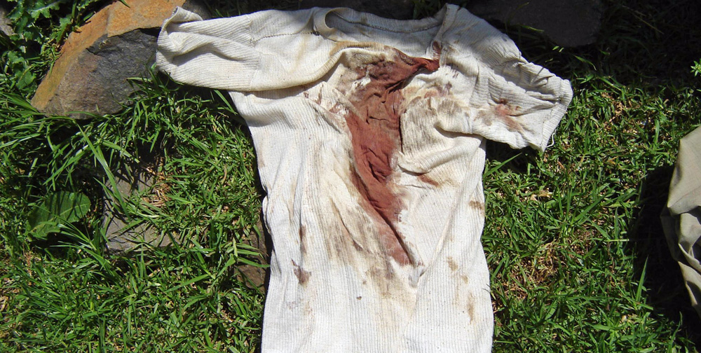 blutiges_hems_open_d